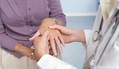 de arts onderzoekt de gewrichten van de handen met artrose en artritis
