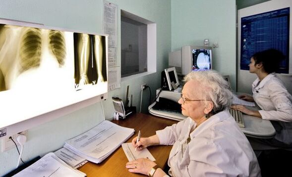 Röntgenfoto's om rugpijn te diagnosticeren