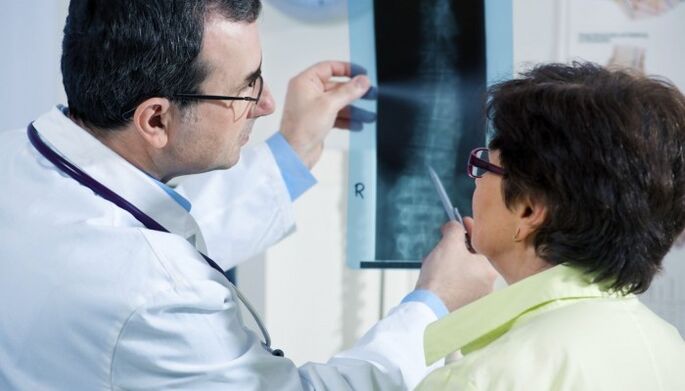 röntgenfoto van de wervelkolom met osteochondrose