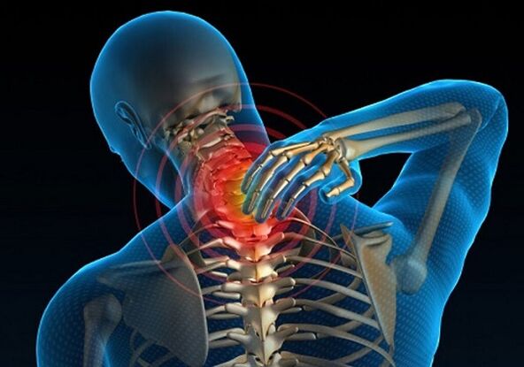 nekpijn als gevolg van osteochondrose