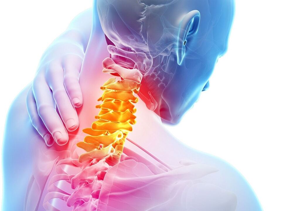 lokalisatie van osteochondrose